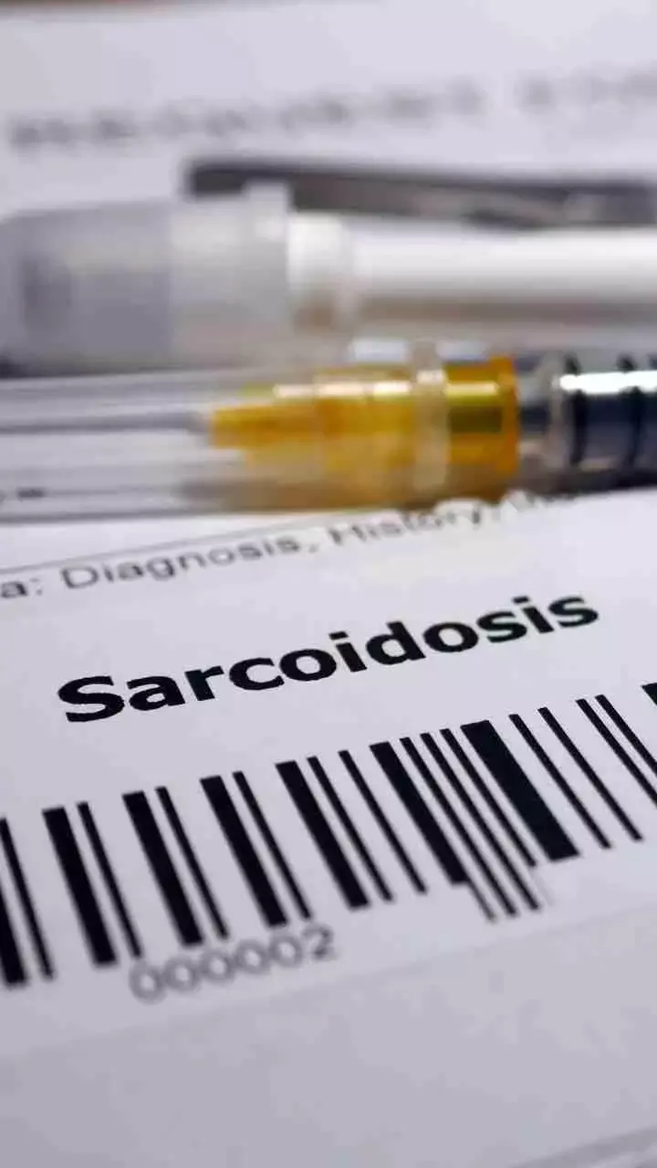 Sarcoidosis: Symptoms, Causes & Treatment And Side Effects