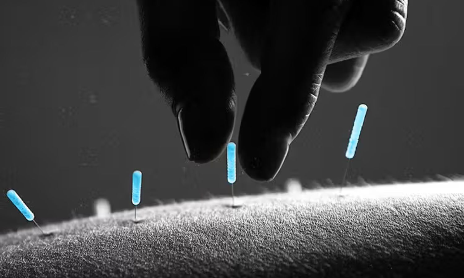 Acupuncture targets mast cells and inflammatory cascade to reduce allergic disorders: Study