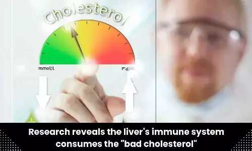 Research reveals the livers immune system consumes the bad cholesterol