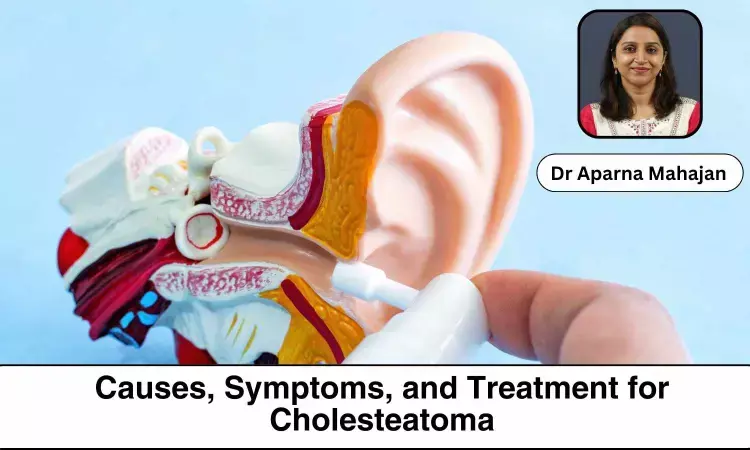 Understanding Cholesteatoma: Causes, Symptoms, and Treatment Options -Dr Aparna Mahajan