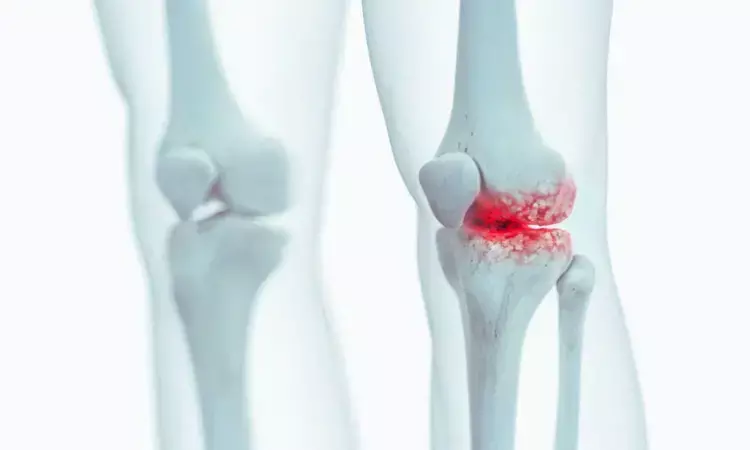 Neutrophil-to-lymphocyte ratio indicative of periprosthetic joint infection after joint replacement: Study