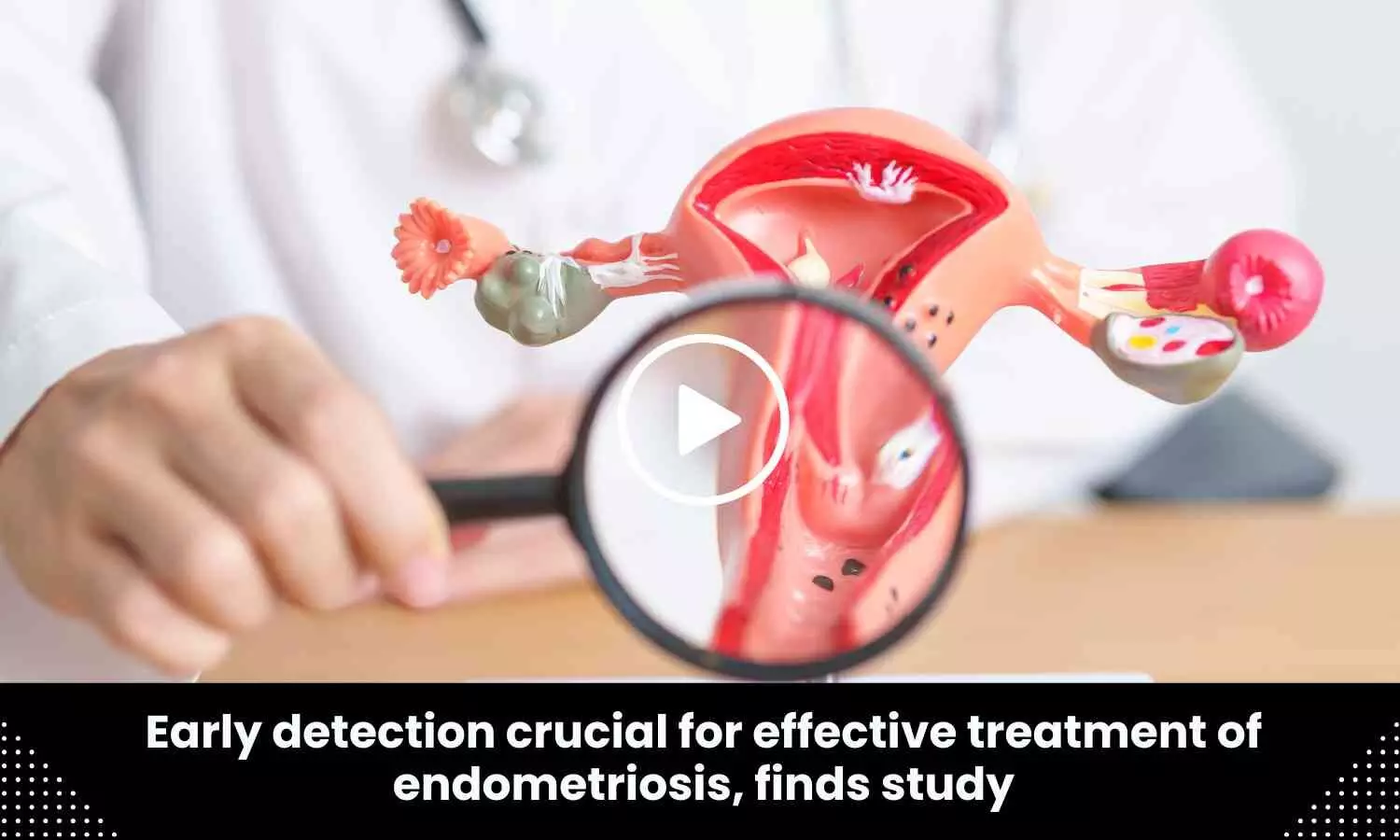 Early detection crucial for effective treatment of endometriosis, finds study