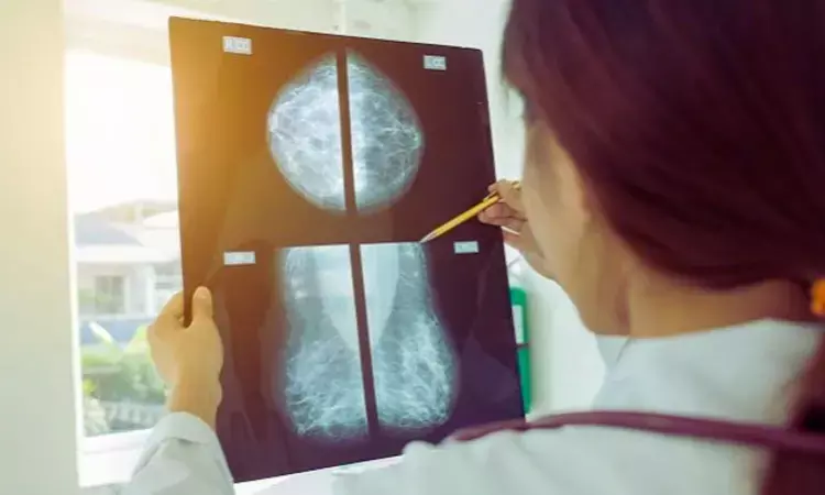 Breast arterial calcification on mammography could identify women at high risk of CVD in future: Study
