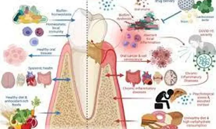 Consumption of dietary live microbes directly associated with improved periodontal health suggests study