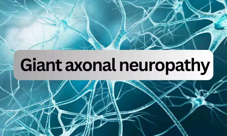 Experimental gene therapy for giant axonal neuropathy promising in clinical trial: NEJM