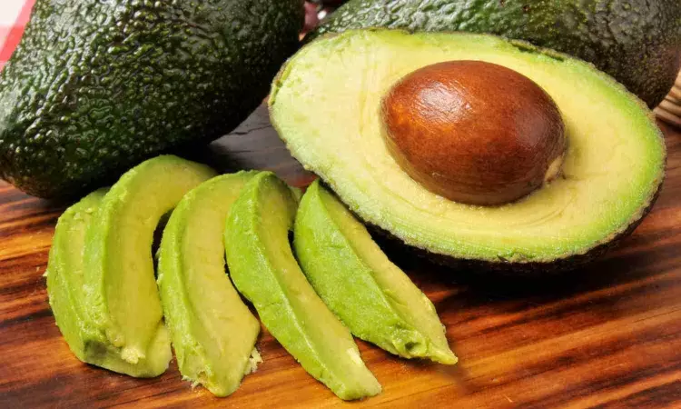 An avocado a day may improve overall diet quality, researchers report