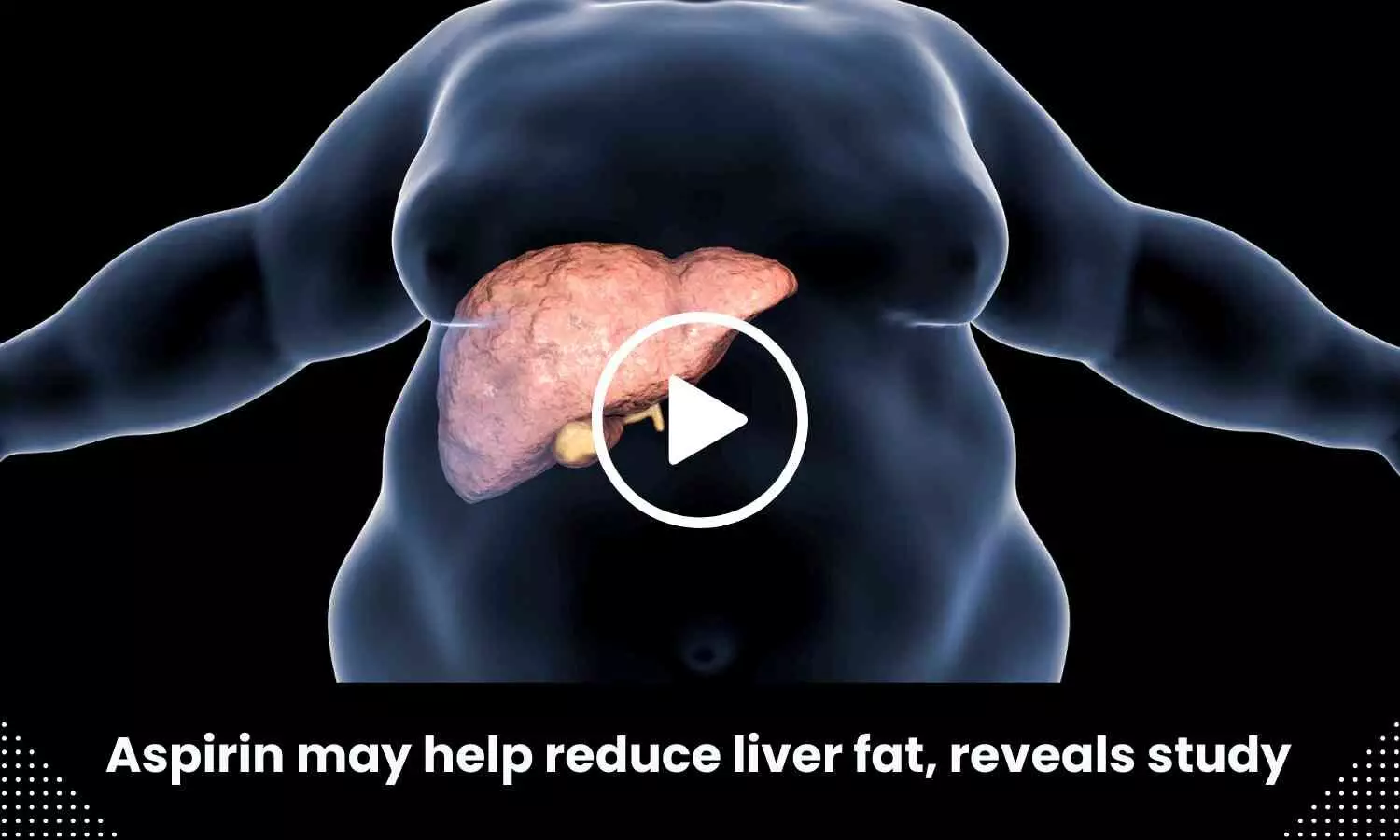 Aspirin may help reduce liver fat, reveals study