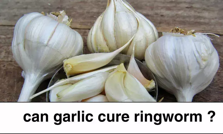 Fact Check: Can garlic cure ringworm?