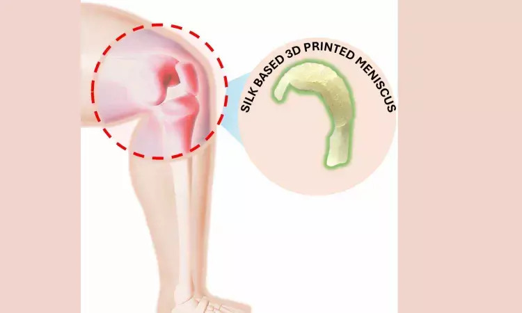 IIT Guwahati Researchers Develop Tailored Solutions Based on Regenerative Therapies for Knee Meniscus Tears