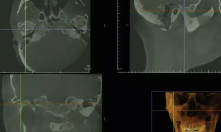 Optical imaging devices useful for diagnosis of periodontal tissue and hard tissue in orthodontic field: Study