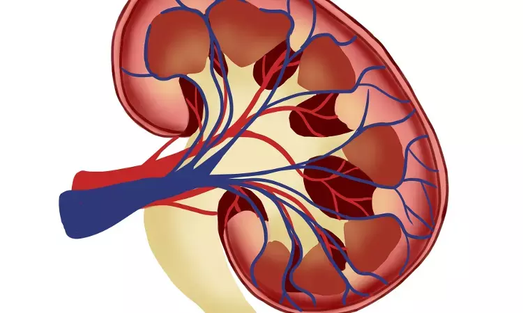 Even Normal-Range Albuminuria May Increase Risk of progression of Kidney  failure among CKD patients: Study