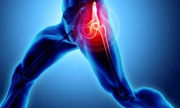 Progressive resistance training as good as neuromuscular exercise for relieving pain in hip OA patients: Study