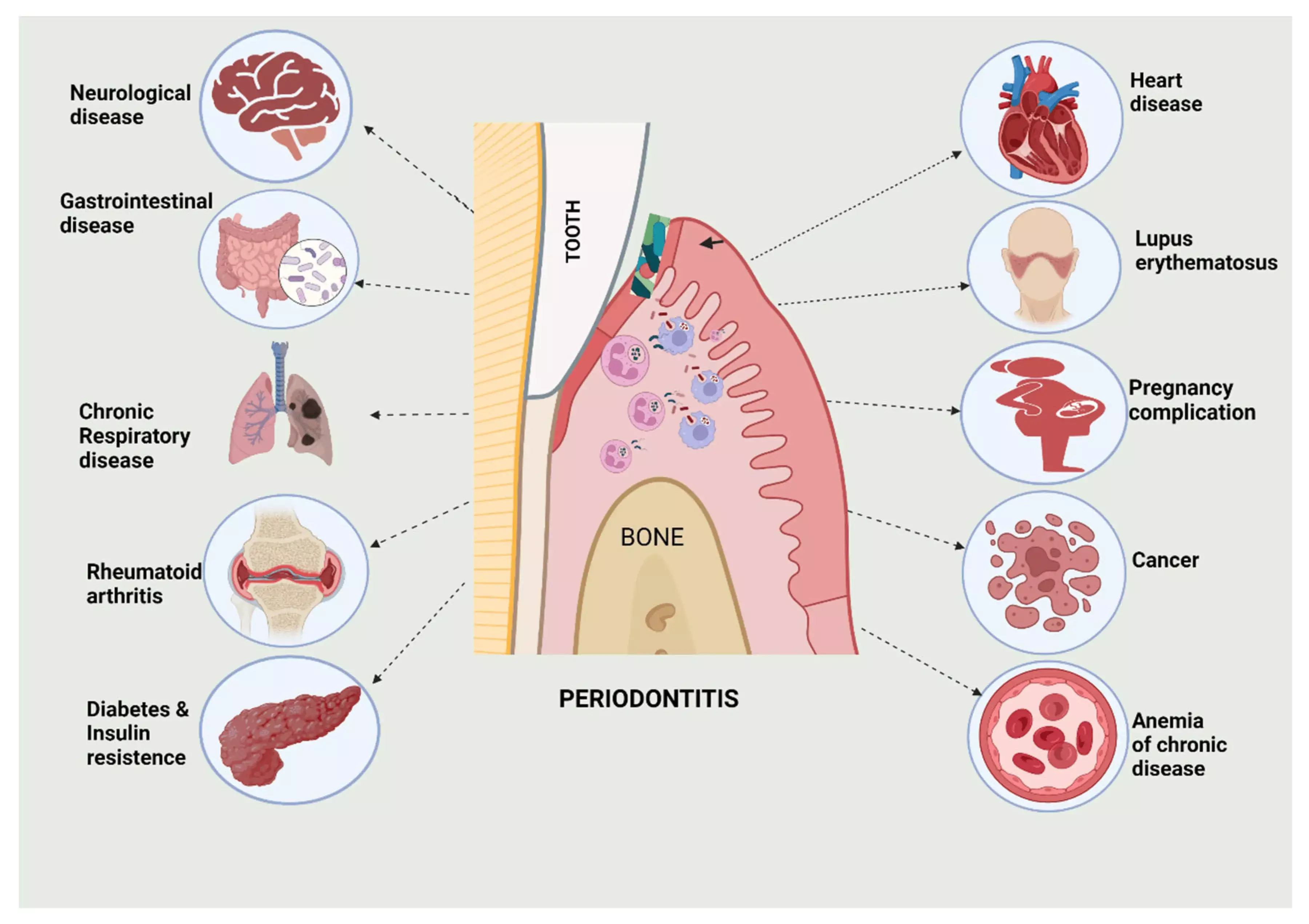 Patients of autoimmune liver disease treated with immune suppressants have lower prevalence of apical periodontitis: Study