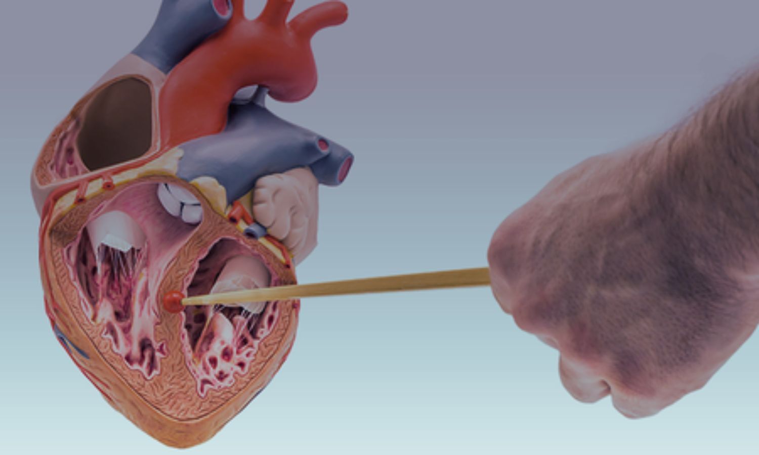 Bisoprolol, Not Verapamil, Reduces Peak Oxygen Consumption in Nonobstructive HCM: Study