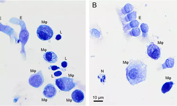 Flow cytometry useful alternative to microscopy for differentiation of bronchoalveolar lavage fluid leukocytes: Study