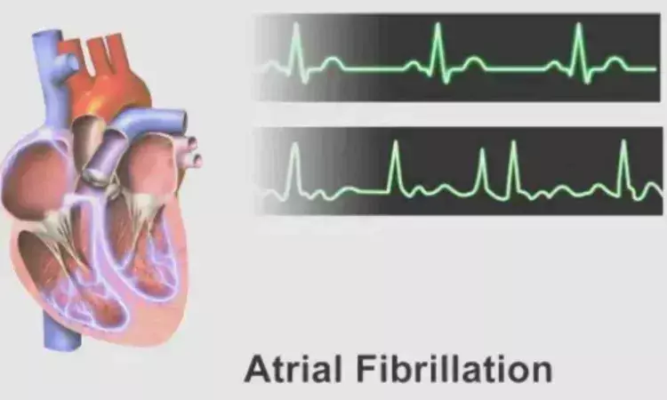 Afib more common and dangerous in younger people than previously thought,  claims study