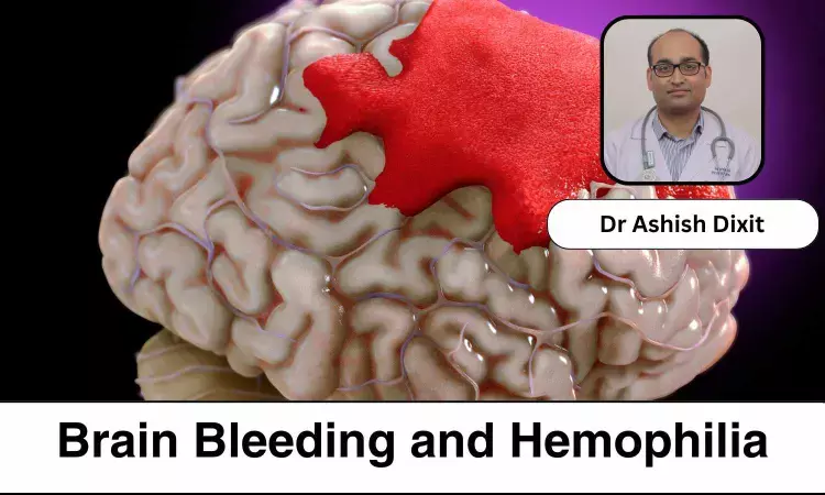 Understanding Brain Bleeds in Hemophilia: Risks and Management - Dr Ashish Dixit