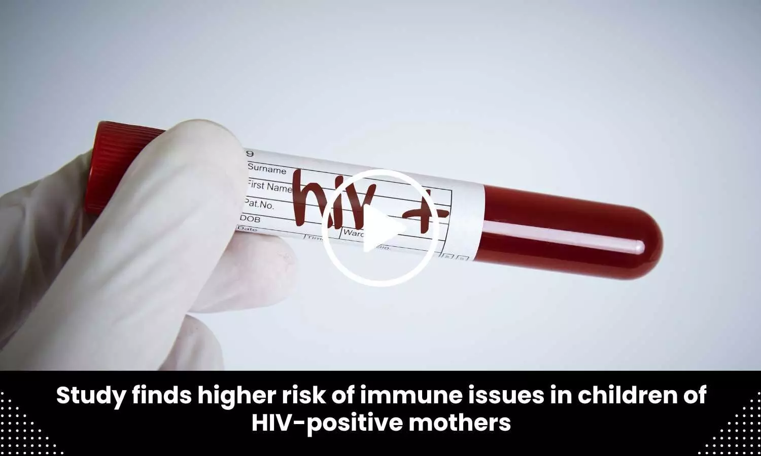 Study finds higher risk of immune issues in children of HIV-positive mothers