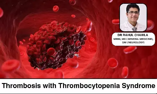 Decoding Thrombosis with Thrombocytopenia Syndrome (TTS): Covid Vaccines Dreadful Adverse Effect-Dr Rahul Chawla