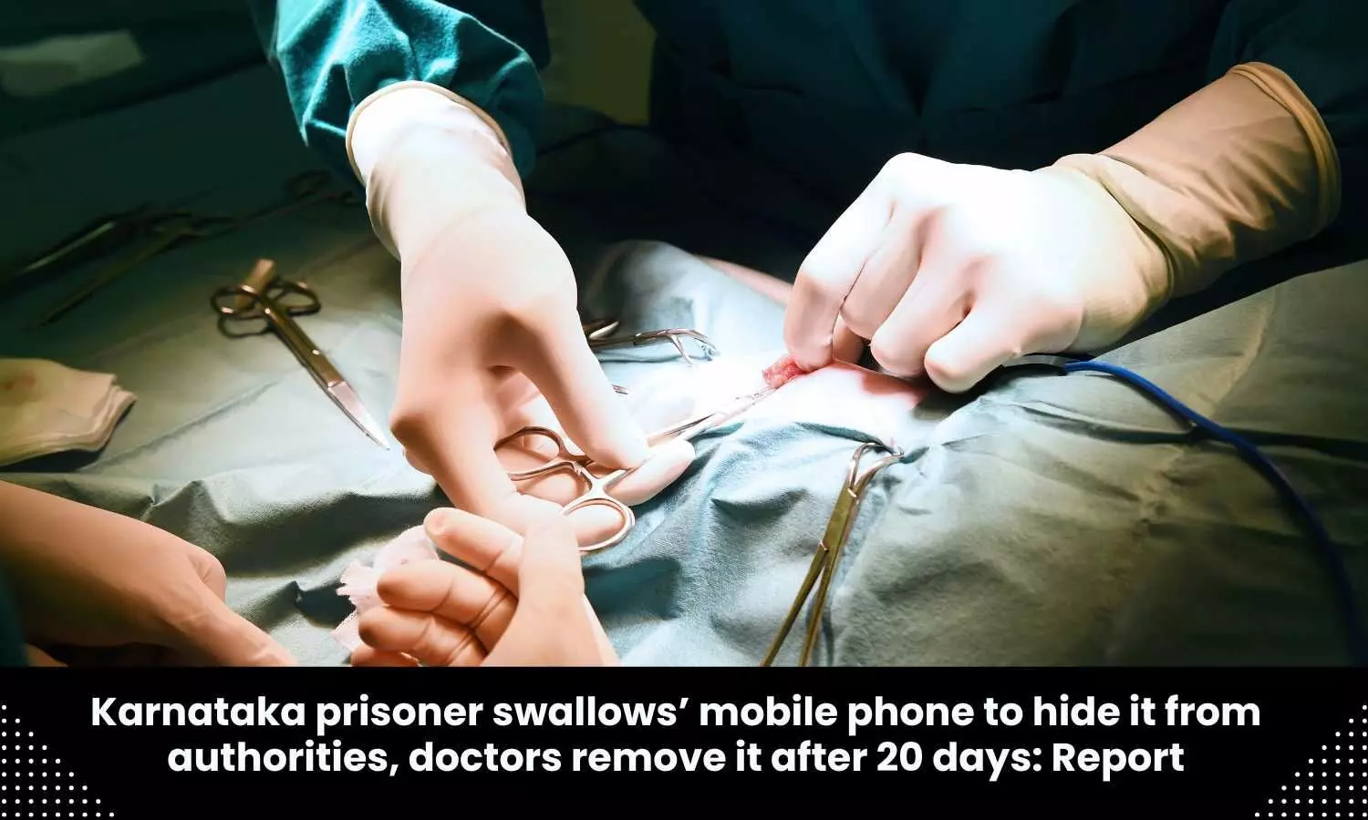 Doctors remove mobile phone from prisoners stomach after 20 days