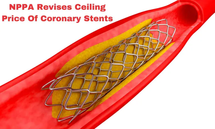 NPPA Revises Ceiling Prices Of Coronary Stents