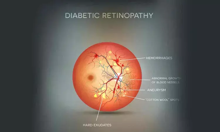 FDA Approves First Fully Autonomous Handheld AI device for Diabetic Retinopathy Screening