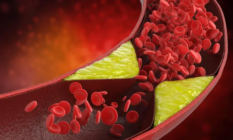 Fact Check: Can consumption of lemon juice and Ghee daily Clear Clogged Arteries And Blood Vessels?