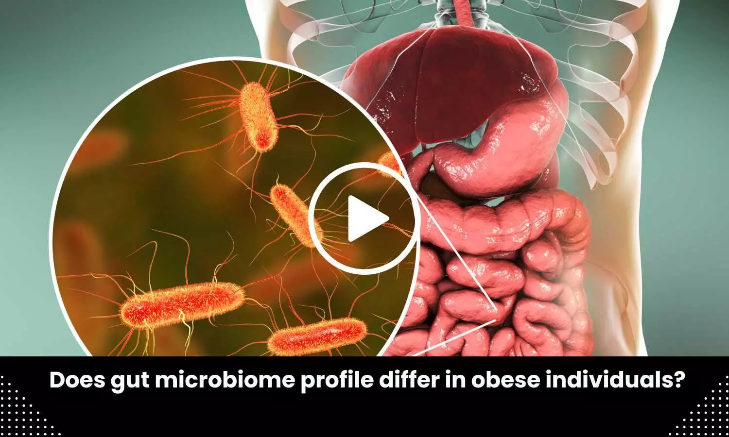 Does gut microbiome profile differ in obese individuals?