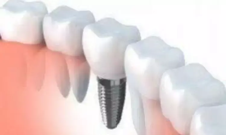 Systematic Review Reveals Impact of Antiresorptive Drugs on Osseointegrated Dental Implants