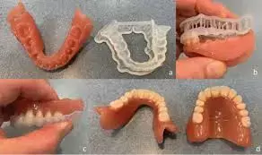 Digital fabrication bests conventional fabrication of dentures in terms of retention, comfort and maintenance: Study