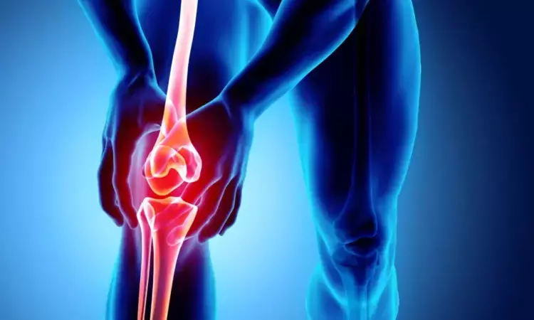 Groundbreaking Study Reveals Long-Term Benefits of Genicular Artery Embolisation for Knee Osteoarthritis Patients