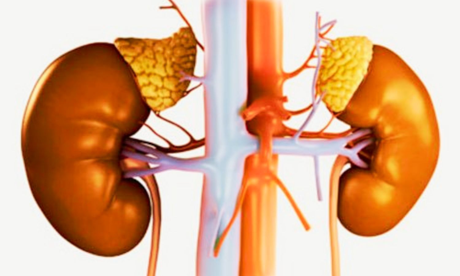 Intravenous Albumin After Paracentesis Reduces Risk of AKI-Related Hospitalization: Study
