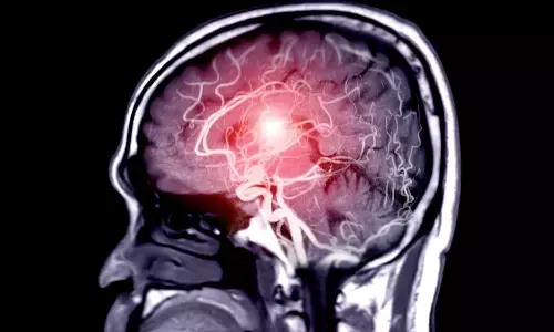 Could taking certain drugs reduce risk of ruptured brain aneurysm? Could taking certain drugs reduce risk of ruptured brain aneurysm?