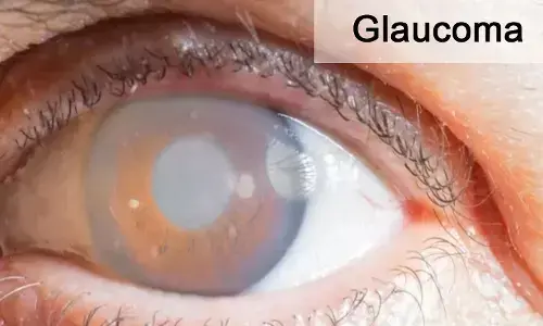 Gland Pharma bags USFDA nod for glaucoma drug Gland Pharma bags USFDA nod for glaucoma drug