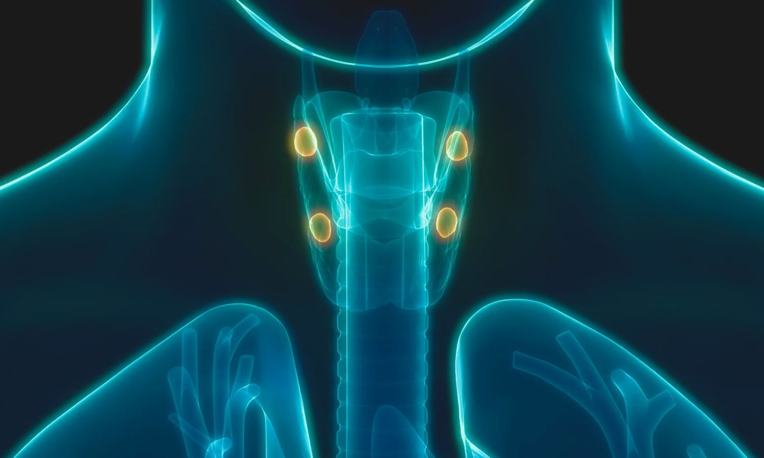 Fracture Risk Assessment Tool May Guide Parathyroidectomy Decisions in Primary Hyperparathyroidism: JAMA