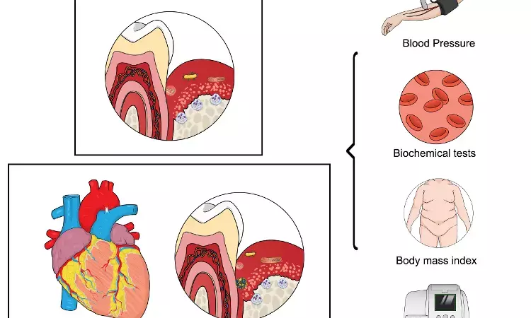 Higher haemoglobin levels are associated with impaired periodontal status: Study