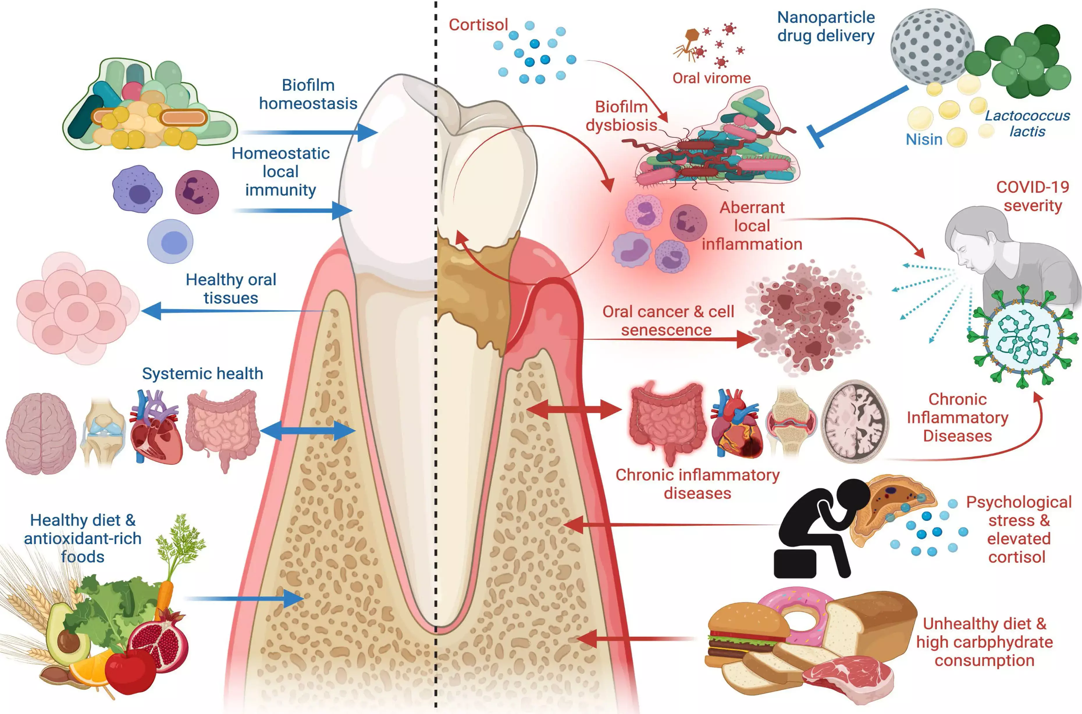 Elderly patients with terminal dentition due to stage IV periodontitis liable to have lower vegetable and micronutrient intake: Study