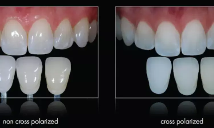 Cross-polarization technique used for shade matching not superior to non-polarization technique, claims study