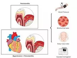 Higher haemoglobin levels linked to impaired periodontal status, suggests study