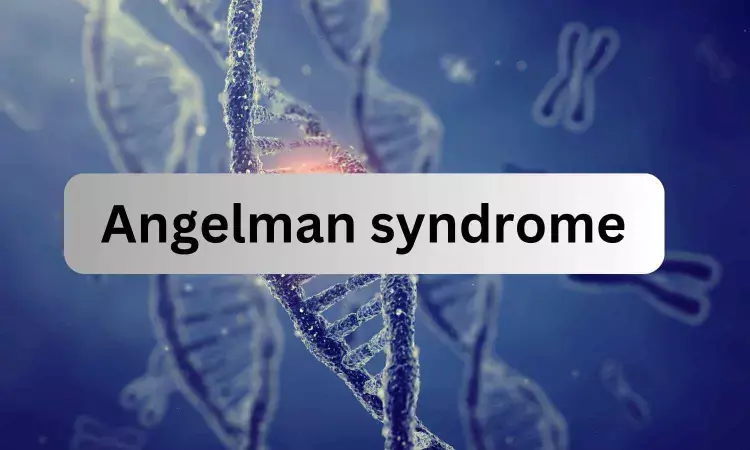 UNC researchers identify potential treatment for Angelman syndrome