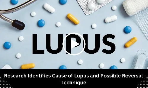 Research Identifies Cause of Lupus and Possible Reversal Technique