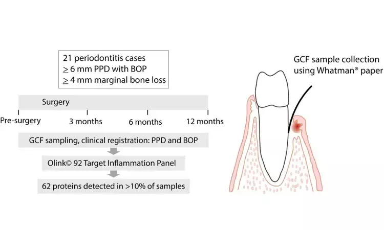 LIGHT protein in gingival crevicular may detect periodontitis recurrence following surgical periodontal therapy: Study