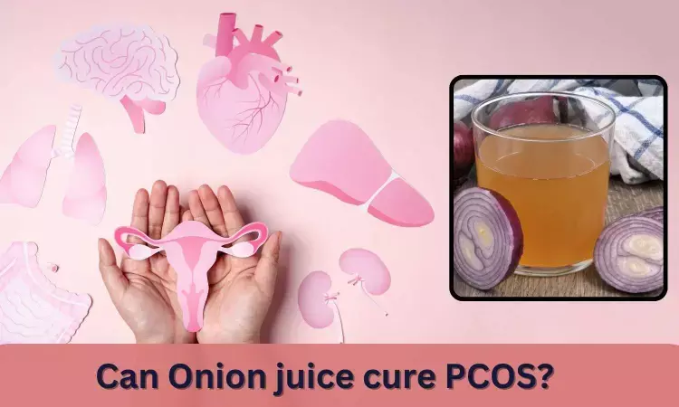Fact Check: Can Onion juice cure PCOS?
