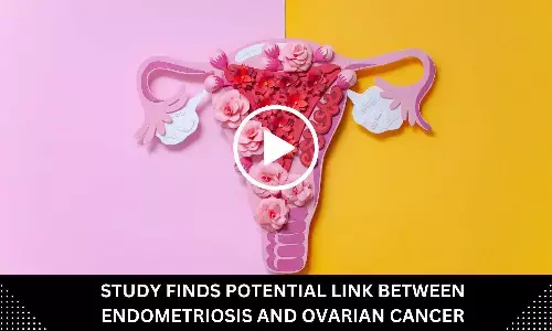 Study Finds Potential Link Between Endometriosis and Ovarian Cancer