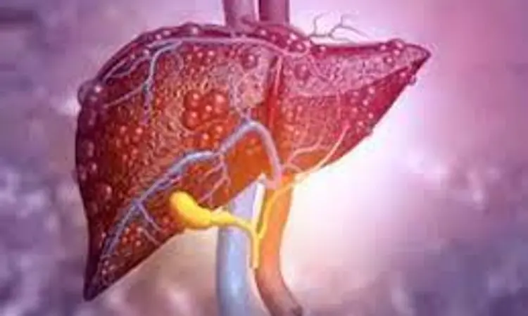 Elevated risks of liver steatosis and Fibrosis in Type 2 diabetes individuals: Study finds