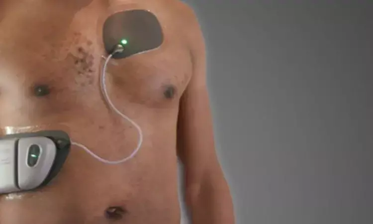 New Wearable Defibrillator Highly Successful in Preventing Sudden Cardiac Arrest with Excellent Patient Adherence: Study