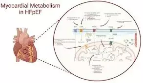 Liraglutide improves myocardial perfusion, myocardial energetics and exercise capacity in Diabetics without CVD: Study