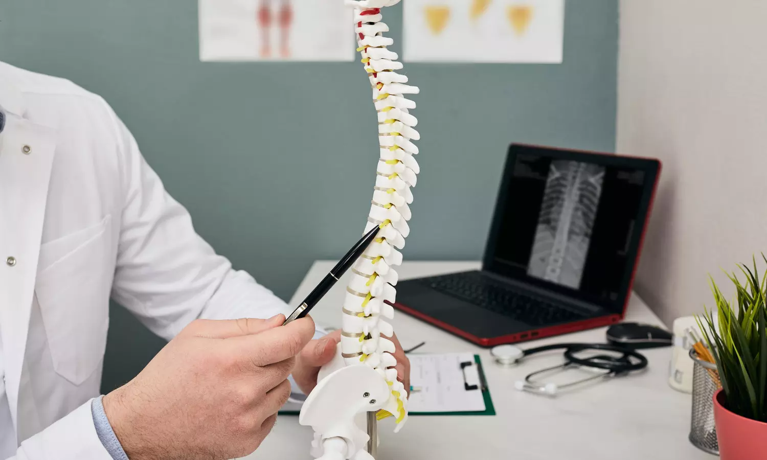 Laminoplasty secure and effective alternative to traditional laminectomy in patients with Intradural Spinal Tumors: study