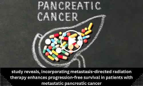 Study reveals, incorporating metastasis-directed radiation therapy enhances progression-free survival in patients with metastatic pancreatic cancer