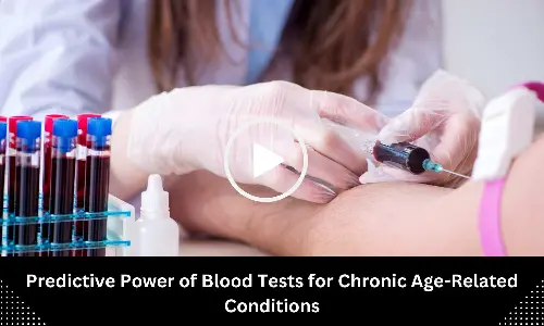 Predictive Power of Blood Tests for Chronic Age-Related Conditions: Research